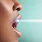 SBIANCAMENTO DENTALE AL LASER