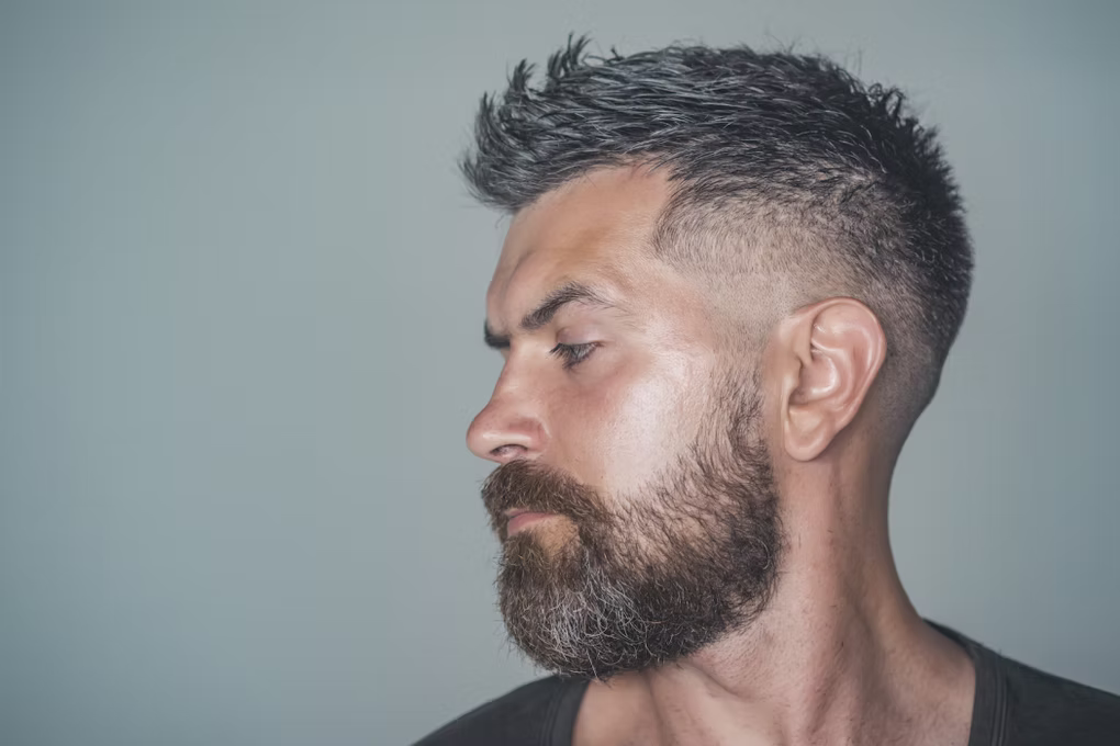 Best beard transplant clinic Turkey providing beard implant Turkey – Medicine Park beard transplant – affordable beard implant Turkey – natural beard transplant results