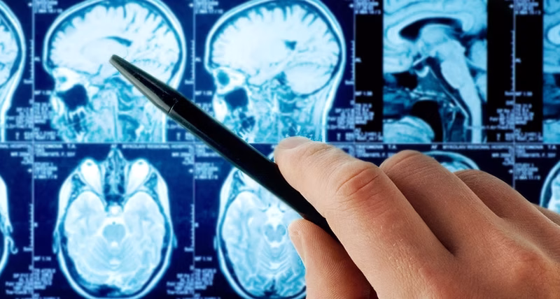 Neurology neurosurgery Turkey multidisciplinary team meeting at top neurology hospital Turkey reviewing complex patient cases